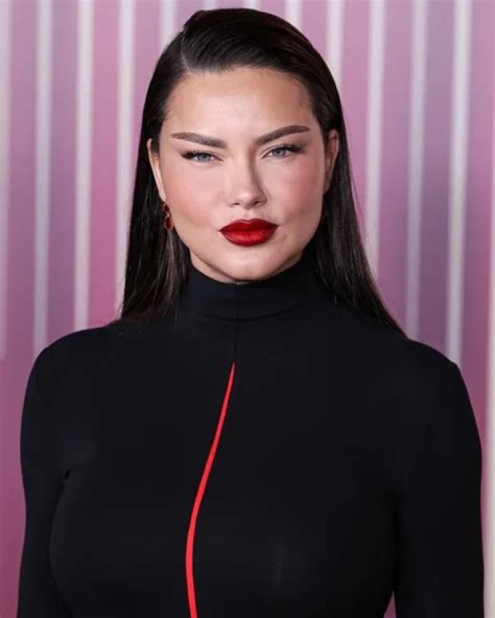 Adriana Lima yaptığı estetikle g&uuml;ndem oldu İşte son hali Magazin