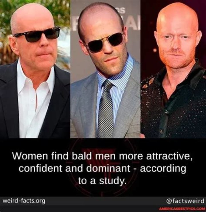 Bald Men Are More Confident, Attractive And Dominant, Study Finds