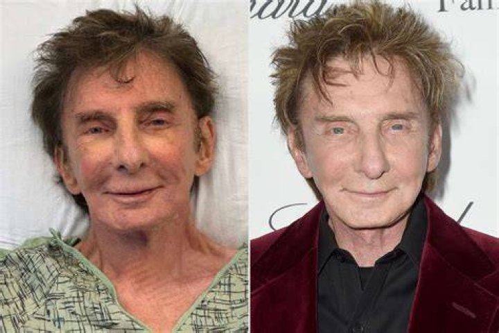 Barry Manilow: Uncovering His Age