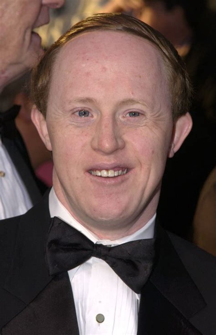 Chris Burke Actor Bio Wiki Age Parents Net Worth Down Syndrome The
