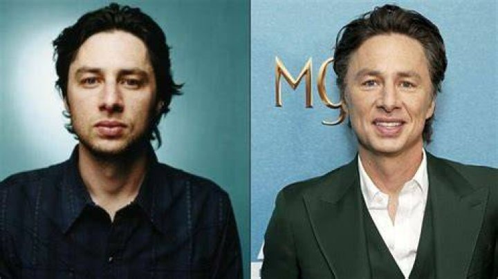 Did Zach Braff Undergo Cosmetic Procedures? Examining The Plastic Surgery Rumors