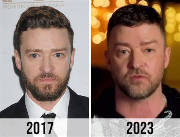 Fans Think Justin Timberlake Had ‘Bad Plastic Surgery’ After His Latest