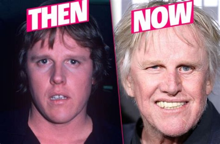 Gary Busey Accident Before And After