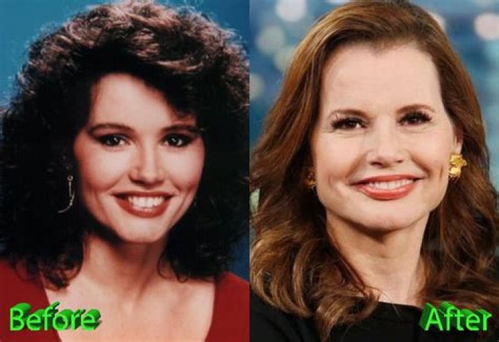 Geena Davis Before And After Plastic Surgery