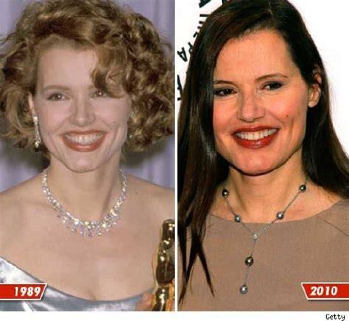 Geena Davis plastic surgery (6) Celebrity plastic surgery online