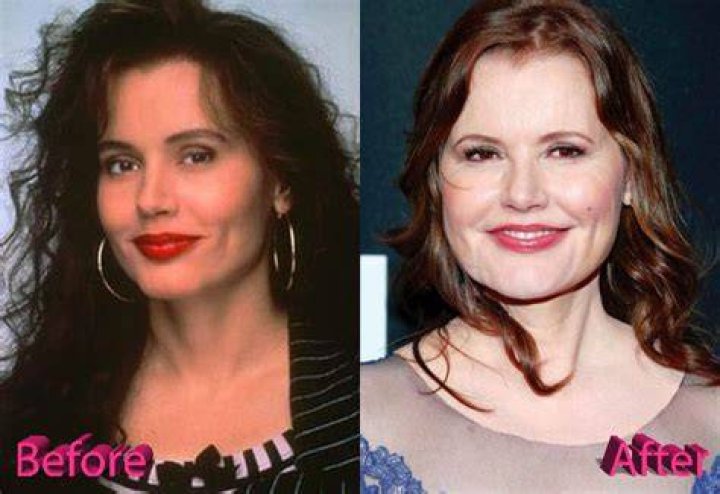 Geena Davis Plastic Surgery Rumors Plastic SurgerYes