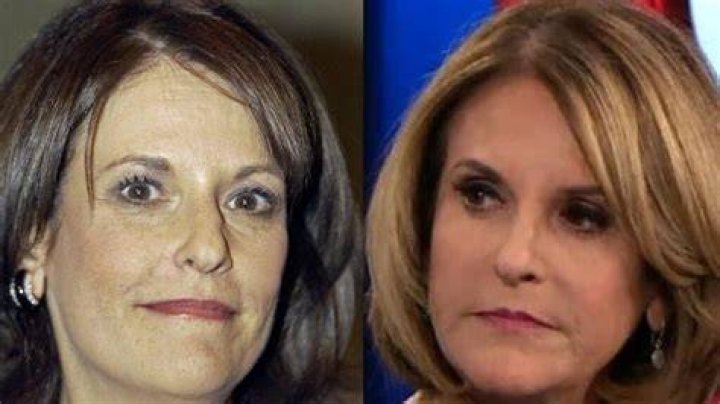 Has Gloria Undergone Plastic Surgery?