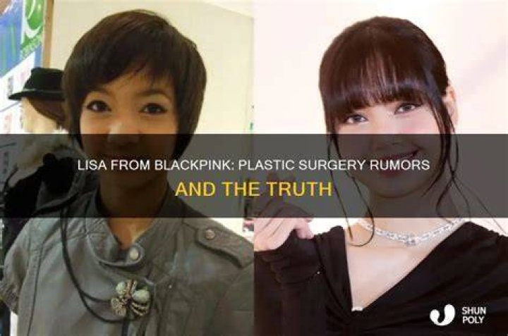 Has Lisa Had Plastic Operation? See Her Transformation In Photos