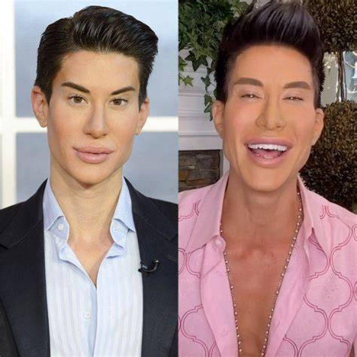 Justin Jedlica: The Human Ken Doll's Incredible Plastic Surgery Journey