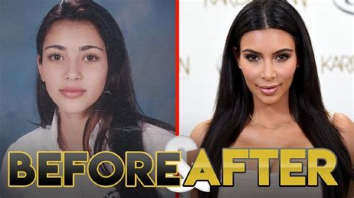 Kim Kardashian Before And After Plastic Surgery Timeline Life & Style