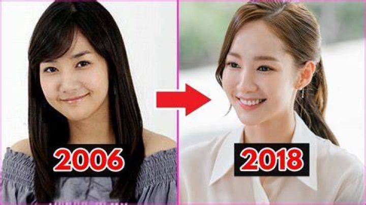 Park Min Young Before And After Plastic Surgery Pics 2018 Plastic