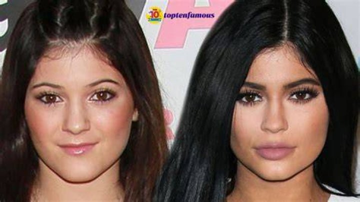 Photos Of Kylie Jenner Then Vs. Now Prove How Much She's Changed Over