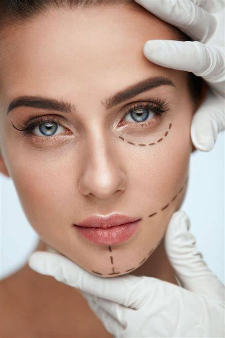 Pin by on Plastic surgery & body enhancements... Kardashian