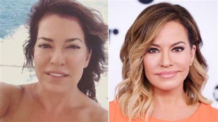 Robin Meade Lip Surgery No Makeup, Before After Pictures