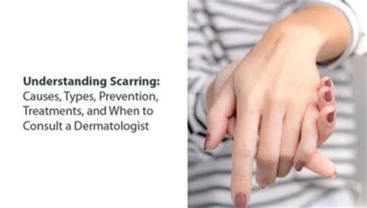 Seal Scarring: Causes, Treatment, And Prevention