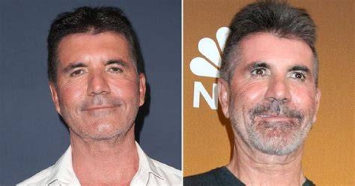 Simon Cowells changing face defended by costar Amanda Holden