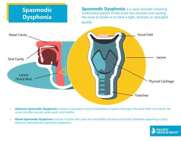 Spasmodic Dysphonia Pacific Head & Neck