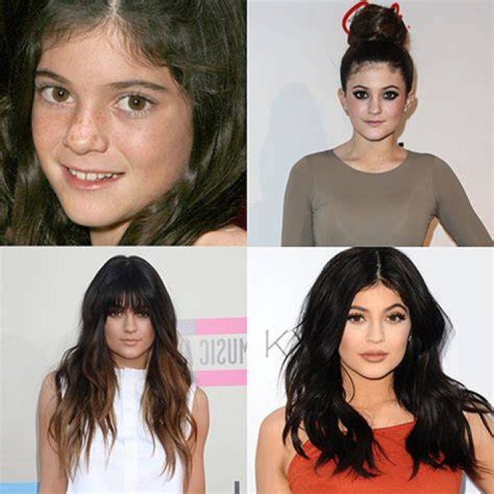 The Beauty Evolution of Kylie Jenner, from FreckleFaced Teen to Full