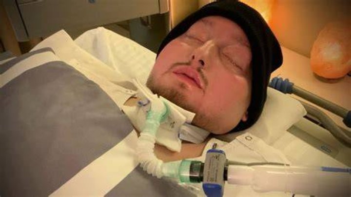 The Enigma Of The "Sleeping Prince": Unraveling The Mystery Of The Coma