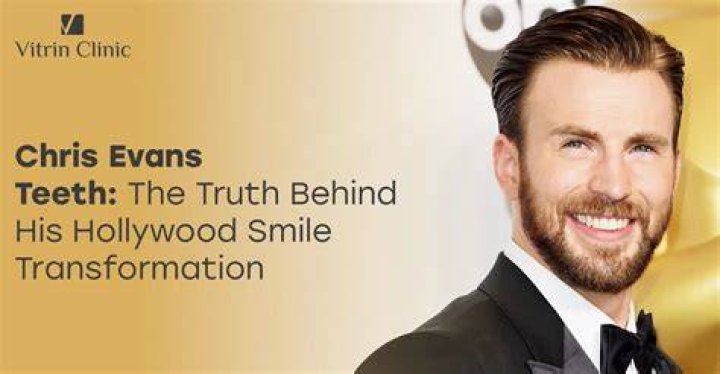 The Truth About Chris Evans' Younger Brother, Scott