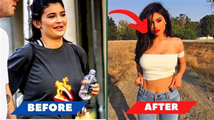 The Unbelievable Transformation Of Kylie Jenner's Weight Loss Journey