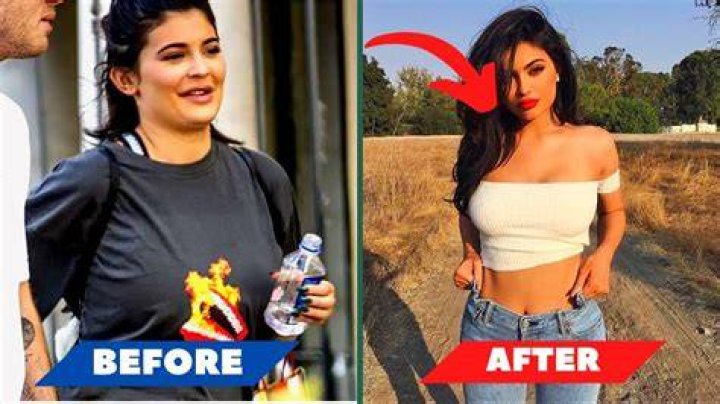 Uncovering The Truth: Kylie Jenner's Weight Loss Journey