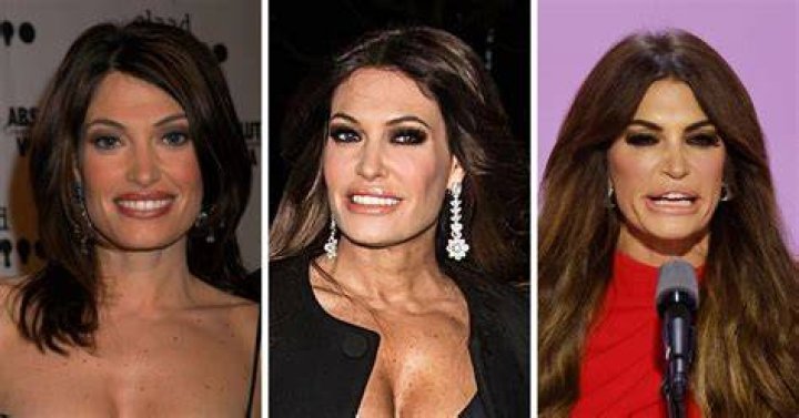 Unveiling Kimberly Guilfoyle's Transformation: From Before To After Trump