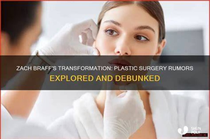 Unveiling The Truth: Cosmetic Surgery Enhancements Of Zach Braff