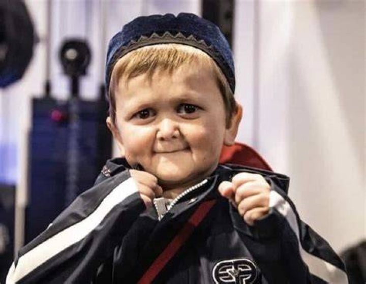 Why Is Hasbulla Magomedov Famous? His Real Age and Condition Explained