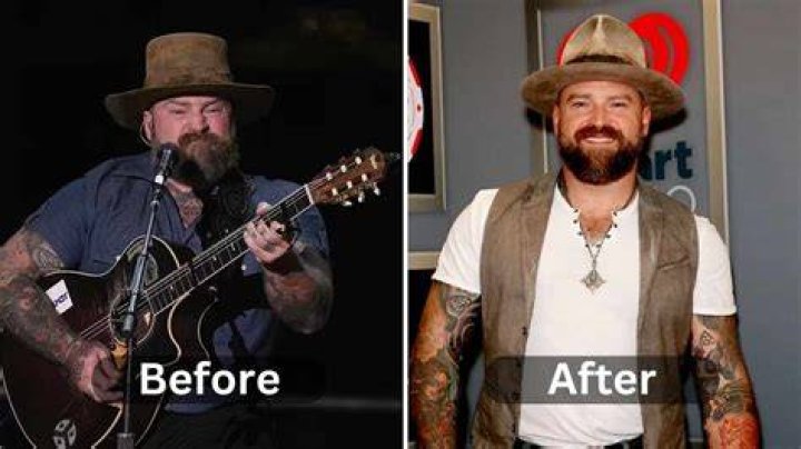 Zac Brown&rsquo;s Weight Loss Transformation Is Thanks to His Hard Work in