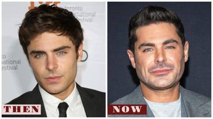 Zac Efron Healing From Surgery After Tearing His ACL E! News Australia