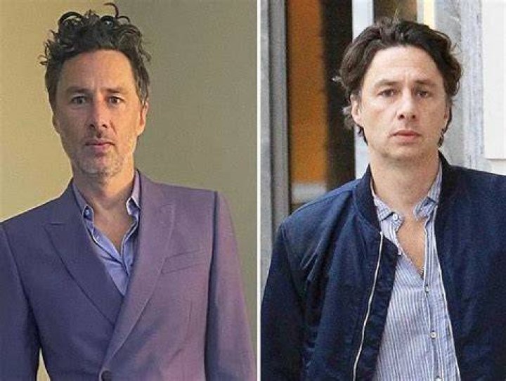 Zach Braff Plastic Surgery Rumors and Facts