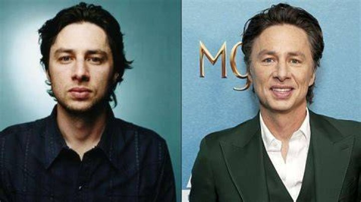Zach Braff Plastic Surgery Speculations Analyzing the Changes Through